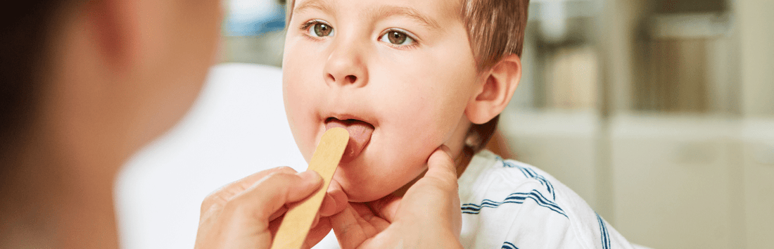 Streptokokken – Ursachen, Symptome und Behandlung der Infektion