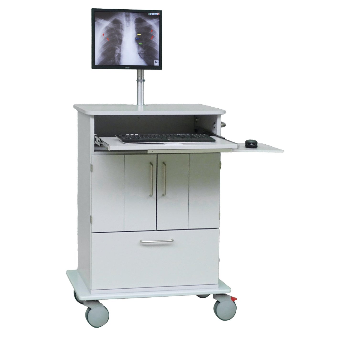 Novocal EDV-vognen har en fuldplastplade, en computerskærm med thoraxrøntgenbillede, en udtrækkelig bakke til tastatur og mus, underliggende opbevaringsrum og hjul til nem transport af IT-udstyr.